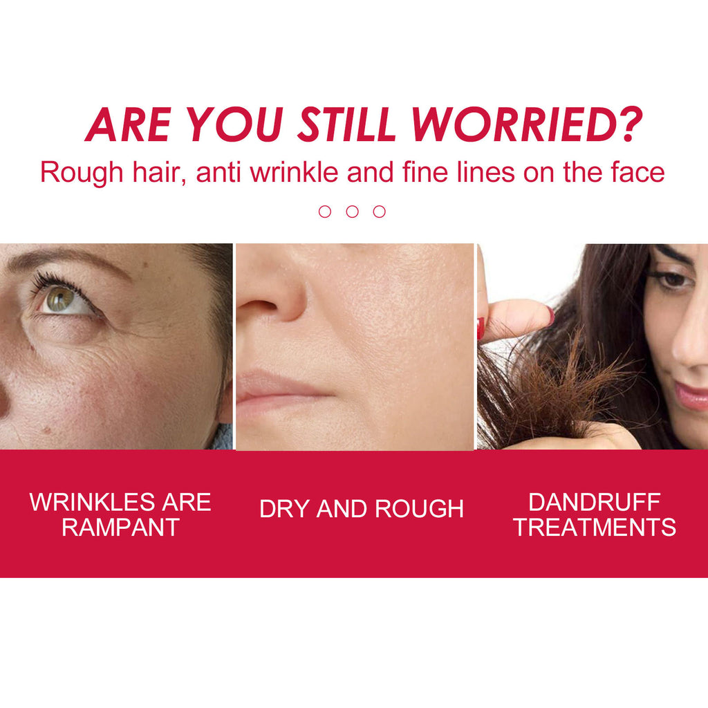 Eelhoe Rosehip Oil: 100% Pure & Natural Certified Organic Skincare